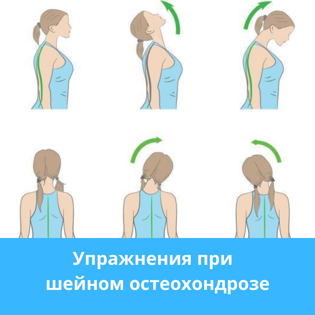 Комплекс упражнений при остеохондрозе шейного отдела позвоночника